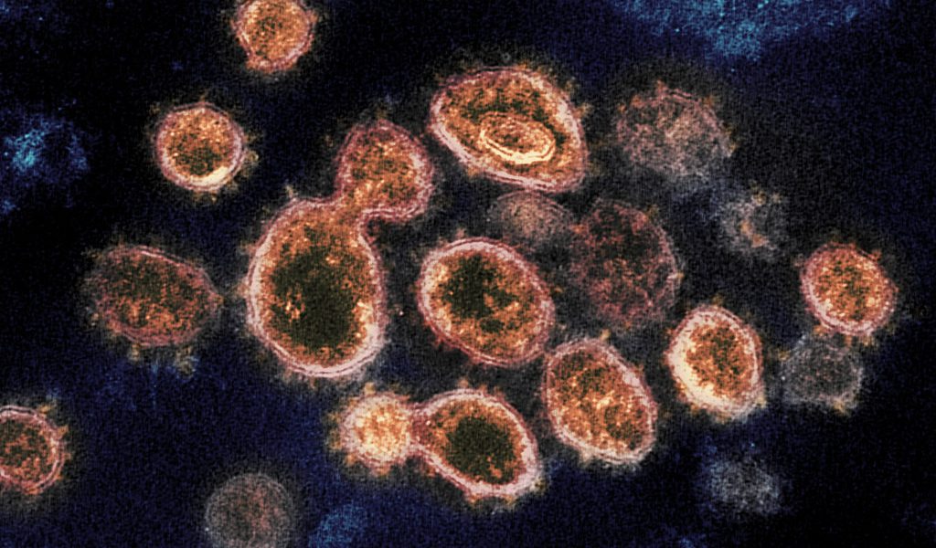 80% of the UK could catch Coronavirus